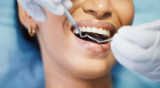 Best Root Canal Emergency Dentist  in South Venice, FL